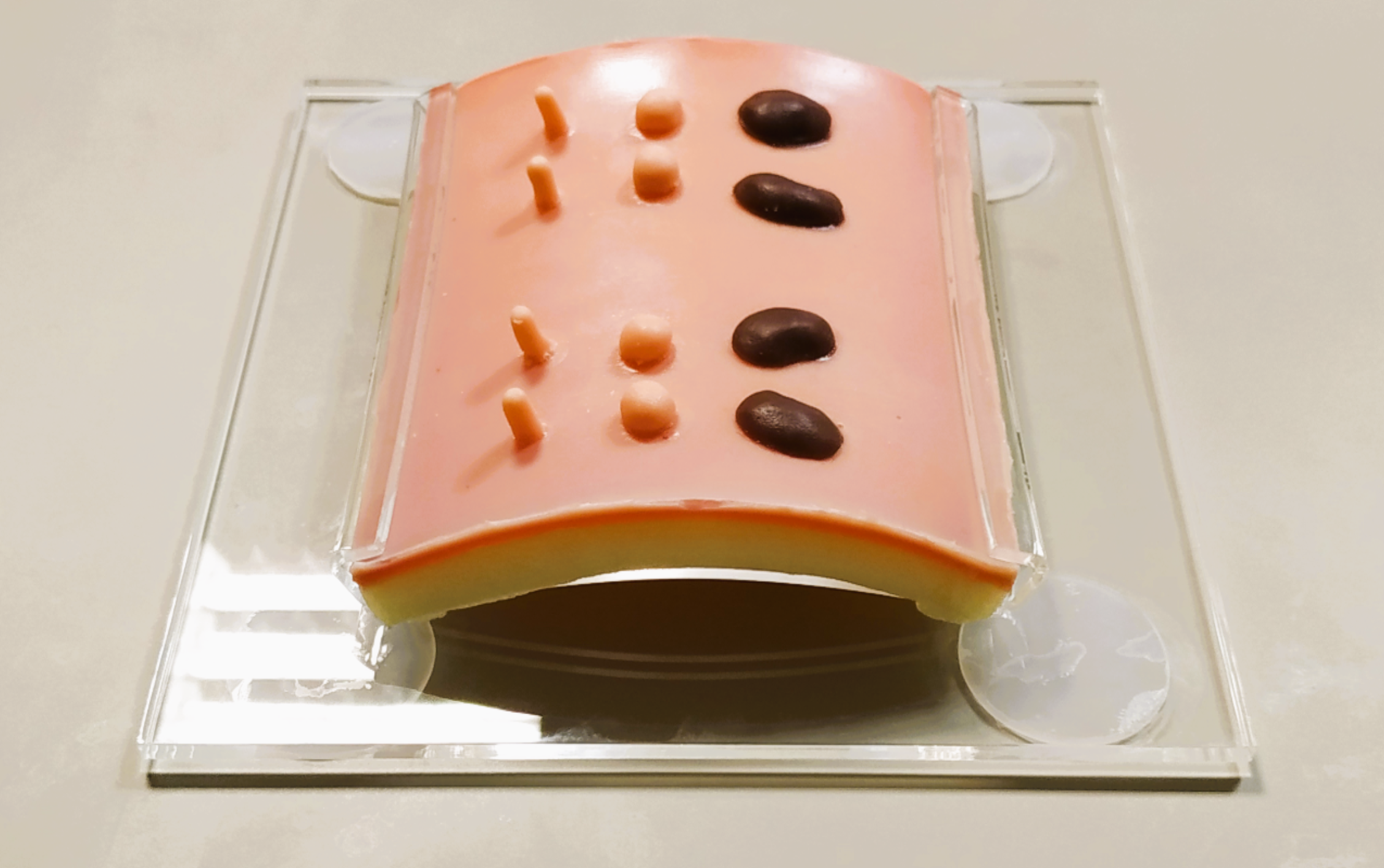 Curettage, Snip & Shave Excision Pad